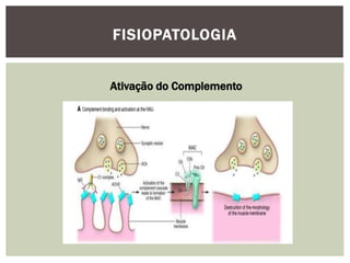 FISIOPATOLOGIA
Ativação do Complemento
 