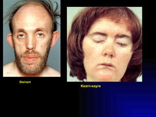 Steinert Kearn-sayre 