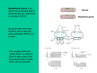Myasthenia Gravis  is an autoimmune Disease that is characterized by a decrease in number of AChR Because there are fewer AChR to bind to the end plate potentials (EPPs) are smaller. With smaller EPPs the “ safety factor” is reduced there is less chance that the post-synaptic muscle fibres will be activated 