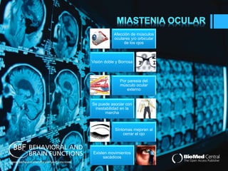 Afección de músculos 
oculares y/o orbicular 
de los ojos 
Visión doble y Borrosa 
Por paresia del 
músculo ocular 
externo 
Se puede asociar con 
inestabilidad en la 
marcha 
Síntomas mejoran al 
cerrar el ojo 
Existen movimientos 
sacádicos 
 