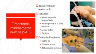 Timectomia Miastenia gravis | PPTX