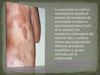 Los pacientes se vuelven sintomáticos cuando el número de receptores de acetilcolina se reduce a aproximadamente el 30% de lo normal. Los receptores colinérgicos del músculo liso y cardíaco tienen una antigenicidad diferente al músculo esquelético y no son afectadas por la enfermedad.  http://esclerodermia- adec.org /sistem1. jpg http:// emedicine.medscape.com / article /793136- overview 
