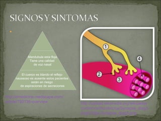 http:// emedicine.medscape.com / article /793136- overview http:// upload.wikimedia.org / wikipedia / commons / thumb /c/ ca / Synapse_diag3 . png /230px- Synapse_diag3 . png Mandubula esta floja Tiene una calidad  de voz nasal El cuerpo es blando el reflejo  nauseoso es ausente estos pacientes  están en riesgo  de aspiraciones de secreciones 