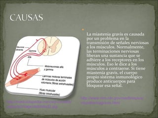 La miastenia gravis es causada por un problema en la transmisión de señales nerviosas a los músculos. Normalmente, las terminaciones nerviosas liberan una sustancia que se adhiere a los receptores en los músculos. Eso le dice a los músculos a contraerse. Si tiene miastenia gravis, el cuerpo propio sistema inmunológico produce anticuerpos para bloquear esa señal. http:// medciclopedia.com / wp - content / uploads / image /debilidad2. jpg http:// www.nlm.nih.gov / medlineplus / myastheniagravis.html 