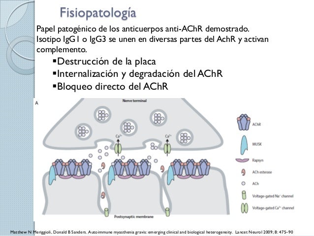 MIASTENIA GRAVIS FISIOPATOLOGIA PDF MIASTENIA GRAVIS FISIOPATOLOGIA PDF