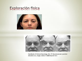 Handbook of Clinical Neurology, Vol. 91 Neuromuscular junction
disorders A.G. Engel, Editor # 2008 Elsevier B.V.
 