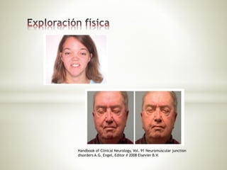 Handbook of Clinical Neurology, Vol. 91 Neuromuscular junction
disorders A.G. Engel, Editor # 2008 Elsevier B.V.
 