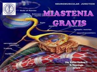 MIASTENIA  GRAVIS Dra. Korina Hazkour F. R1 Neurología 01/02/11 