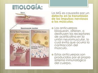La MG es causada por un 
defecto en la transmisión 
de los impulsos nerviosos 
a los músculos. 
 Los anticuerpos 
bloquean, alteran, o 
destruyen los receptores 
de acetilcolina en la 
unión neuromuscular, lo 
cual evita que ocurra la 
contracción del 
músculo. 
 Estos anticuerpos son 
producidos por el propio 
sistema inmunológico 
del cuerpo. 
 