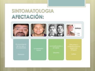 El movimiento 
de los ojos y 
los párpados 
Diplopía 
La expresión 
facial 
La masticación y 
el habla 
Disartria 
Dificultad o 
molestia para la 
deglución 
(tragar) 
Asfixia 
 