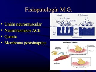 Fisiopatología M.G.
• Unión neuromuscular
• Neurotrasmisor ACh
• Quanta
• Membrana postsináptica
 