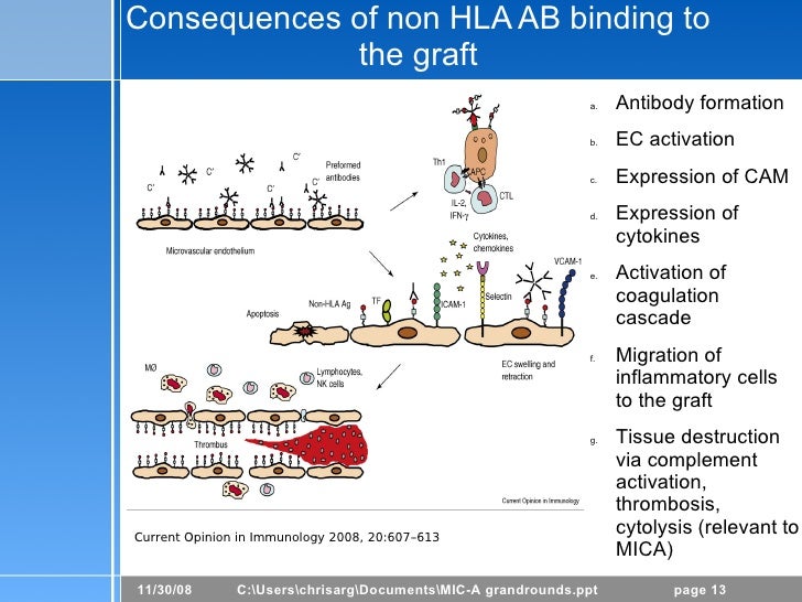 MICA Antibodies in Renal Transplantation