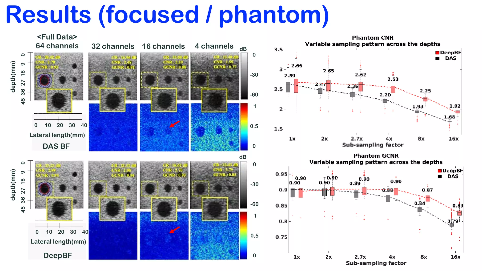 Deep Learning-Based Universal Beamformer for Ultrasound Imaging | PDF