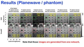 Deep Learning-Based Universal Beamformer for Ultrasound Imaging | PDF