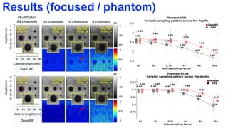 Deep Learning-Based Universal Beamformer for Ultrasound Imaging | PDF