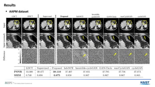 Patch-wise Deep Metric Learning for Unsupervised Low-Dose CT Denoising ...