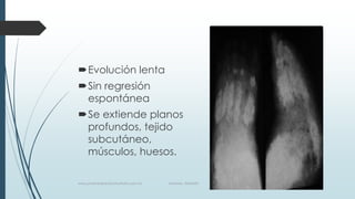 Evolución lenta
Sin regresión
espontánea
Se extiende planos
profundos, tejido
subcutáneo,
músculos, huesos.
www.pharmedsolutionsinstitute.com.mx Informes. 36246001
 