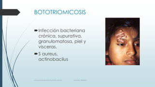 BOTOTRIOMICOSIS
Infección bacteriana
crónica, supurativa,
granulomatosa, piel y
visceras.
S aureus,
actinobacilus
www.pharmedsolutionsinstitute.com.mx Informes. 36246001
 