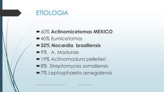 ETIOLOGIA
60% Actinomicetomas MEXICO
40% Eumicetomas
32% Nocardia brasiliensis
9% A. Madurae
19% Actinomadura pelletieri
8% Streptomyces somaliensis
7% Leptosphaeria senegalensis
www.pharmedsolutionsinstitute.com.mx Informes. 36246001
 