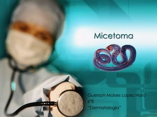 Micetoma
Guerson Moises Lopez Haro
6°E
“Dermatologia”
 