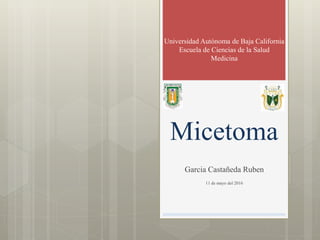 Universidad Autónoma de Baja California
Escuela de Ciencias de la Salud
Medicina
Garcia Castañeda Ruben
11 de mayo del 2016
Micetoma
 