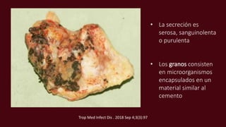 • La secreción es
serosa, sanguinolenta
o purulenta
• Los granos consisten
en microorganismos
encapsulados en un
material similar al
cemento
Trop Med Infect Dis . 2018 Sep 4;3(3):97
 