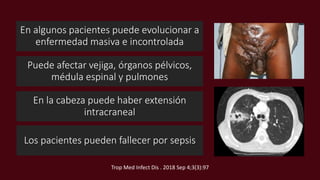 En algunos pacientes puede evolucionar a
enfermedad masiva e incontrolada
Puede afectar vejiga, órganos pélvicos,
médula espinal y pulmones
En la cabeza puede haber extensión
intracraneal
Los pacientes pueden fallecer por sepsis
Trop Med Infect Dis . 2018 Sep 4;3(3):97
 
