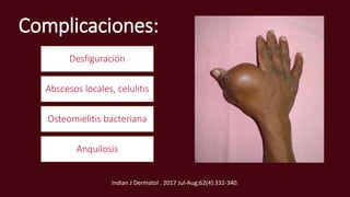 Complicaciones:
Desfiguración
Abscesos locales, celulitis
Osteomielitis bacteriana
Anquilosis
Indian J Dermatol . 2017 Jul-Aug;62(4):332-340.
 