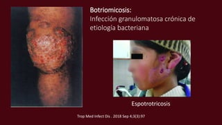 Botriomicosis:
Infección granulomatosa crónica de
etiología bacteriana
Espotrotricosis
Trop Med Infect Dis . 2018 Sep 4;3(3):97
 