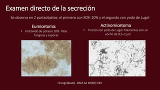 Examen directo de la secreción
Se observa en 2 portaobjetos: el primero con KOH 10% y el segundo con yodo de Lugol
Actinomicetoma
• Tinción con yodo de Lugol: filamentos con un
ancho de 0,5–1 µm
Eumicetoma:
• Hidróxido de potasio 10%: hifas
fúngicas y esporas
J Fungi (Basel) . 2022 Jul 19;8(7):743.
 
