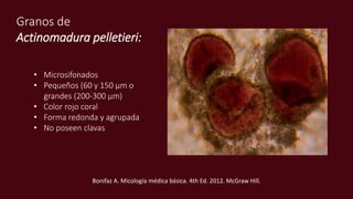 Granos de
Actinomadura pelletieri:
• Microsifonados
• Pequeños (60 y 150 μm o
grandes (200-300 μm)
• Color rojo coral
• Forma redonda y agrupada
• No poseen clavas
Bonifaz A. Micología médica básica. 4th Ed. 2012. McGraw Hill.
 