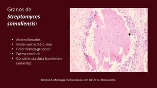 Granos de
Streptomyces
somaliensis:
• Microsifonados
• Miden entre 0.5-1 mm
• Color blanco-grisáceo
• Forma redonda
• Consistencia dura (contienen
cemento)
Bonifaz A. Micología médica básica. 4th Ed. 2012. McGraw Hill.
 