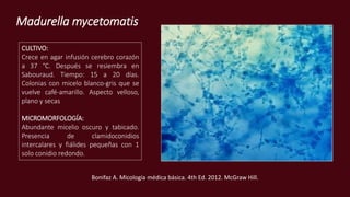 Madurella mycetomatis
CULTIVO:
Crece en agar infusión cerebro corazón
a 37 °C. Después se resiembra en
Sabouraud. Tiempo: 15 a 20 días.
Colonias con micelo blanco-gris que se
vuelve café-amarillo. Aspecto velloso,
plano y secas
MICROMORFOLOGÍA:
Abundante micelio oscuro y tabicado.
Presencia de clamidoconidios
intercalares y fiálides pequeñas con 1
solo conidio redondo.
Bonifaz A. Micología médica básica. 4th Ed. 2012. McGraw Hill.
 