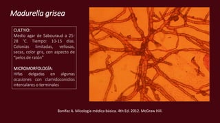 Madurella grisea
CULTIVO:
Medio agar de Sabouraud a 25-
28 °C. Tiempo: 10-15 días.
Colonias limitadas, vellosas,
secas, color gris, con aspecto de
“pelos de ratón”
MICROMORFOLOGÍA:
Hifas delgadas en algunas
ocasiones con clamidoconidios
intercalares o terminales
Bonifaz A. Micología médica básica. 4th Ed. 2012. McGraw Hill.
 