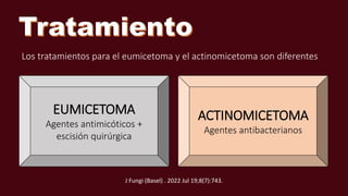 Los tratamientos para el eumicetoma y el actinomicetoma son diferentes
EUMICETOMA
Agentes antimicóticos +
escisión quirúrgica
ACTINOMICETOMA
Agentes antibacterianos
J Fungi (Basel) . 2022 Jul 19;8(7):743.
 