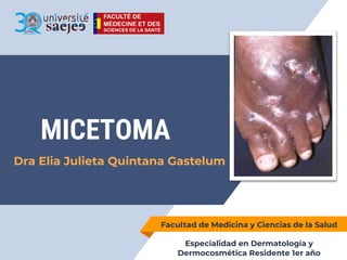 MICETOMA
Dra Elia Julieta Quintana Gastelum
Facultad de Medicina y Ciencias de la Salud
Especialidad en Dermatología y
Dermocosmética Residente 1er año
 