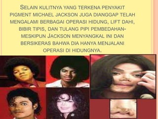 SELAIN KULITNYA YANG TERKENA PENYAKIT
PIGMENT MICHAEL JACKSON JUGA DIANGGAP TELAH
MENGALAMI BERBAGAI OPERASI HIDUNG, LIFT DAHI,
   BIBIR TIPIS, DAN TULANG PIPI PEMBEDAHAN-
    MESKIPUN JACKSON MENYANGKAL INI DAN
    BERSIKERAS BAHWA DIA HANYA MENJALANI
              OPERASI DI HIDUNGNYA.
 