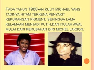 PADA TAHUN 1980-AN KULIT MICHAEL YANG
TADINYA HITAM TERKENA PENYAKIT
KEKURANGAN PIGMENT, SEHINGGA LAMA
KELAMAAN MENJADI PUTIH,DAN ITULAH AWAL
MULAI DARI PERUBAHAN DIRI MICHEL JAKSON.
 