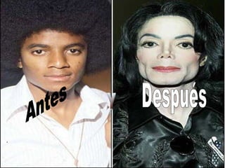 Antes Y Después . 