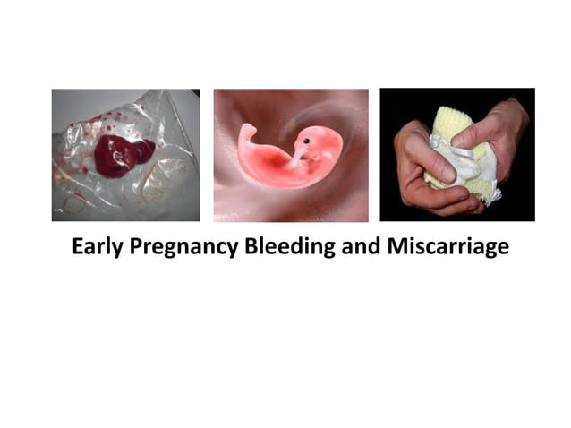 Gynaecology Early Pregnancy Complication PDF Pregnancy