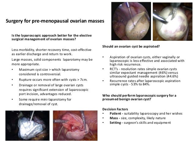 Get Adnexal Masses PNG
