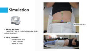 Simulation
• Patient is scanned
With 3 bb’s (RT, LT, Center) placed at arbitrary
point in pelvic area
• Setup Equipment:
- Pillows under head
- Combi Fix board
- Hands on chest
Marking Origin (MO)
 