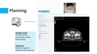 Planning PLANNING
Outside of bore
The bb’s are the
coordinates used for
patient setup.
Inside bore
Patient is loaded to
treatment plan isocenter
 