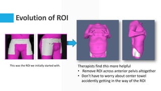 Evolution of ROI
This was the ROI we initially started with. Therapists find this more helpful
• Remove ROI across anterior pelvis altogether
• Don’t have to worry about center towel
accidently getting in the way of the ROI
 