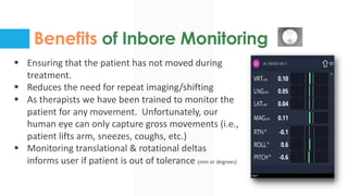 Benefits of Inbore Monitoring
§ Ensuring that the patient has not moved during
treatment.
§ Reduces the need for repeat imaging/shifting
§ As therapists we have been trained to monitor the
patient for any movement. Unfortunately, our
human eye can only capture gross movements (i.e.,
patient lifts arm, sneezes, coughs, etc.)
§ Monitoring translational & rotational deltas
informs user if patient is out of tolerance (mm or degrees)
 