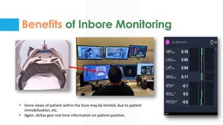 Benefits of Inbore Monitoring
• Some views of patient within the bore may be limited, due to patient
immobilization, etc.
• Again, deltas give real time information on patient position.
 