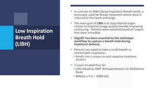 § In contrast to DIBH (Deep Inspiration Breath Hold), a
technique used for breast treatment where dose is
reduced to the heart and lungs.
§ The main goal of LIBH is to stop internal organ
motion to improve image quality thereby improving
contouring. Patients were selected based on targets
that were immobile.
§ AlignRT has been essential to this technique
workflow to capture a breath hold during
treatment delivery.
§ Patients are asked to take a small breath or
comfortable inspiration.
§ Breath size is unique to each adaptive treatment
session)
§ 5 Cases treated thus far:
§ LIBH Adaptive SBRT Retroperitoneum or Abdominal
Node
§ 800cGy x 5 fx – 4000 cGy
Low Inspiration
Breath Hold
(LIBH)
 