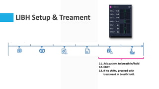 LIBH Setup & Treament
11. Ask patient to breath in/hold
12. CBCT
13. If no shifts, proceed with
treatment in breath hold.
 