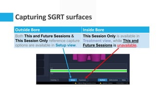 Capturing SGRT surfaces
Outside Bore Inside Bore
Both This and Future Sessions &
This Session Only reference capture
options are available in Setup view.
This Session Only is available in
Treatment view, while This and
Future Sessions is unavailable.
 