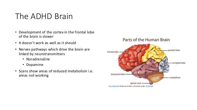 Michelle - The world of ADHD According to S.P.A.C.E. medication prese…